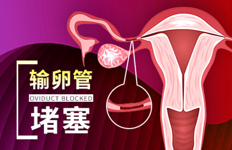 输卵管堵塞