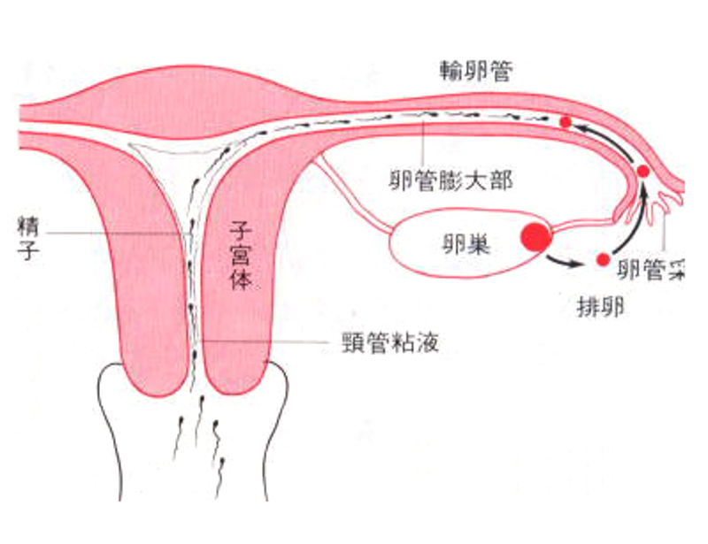 输卵管堵塞:现代女性健康的隐形杀手